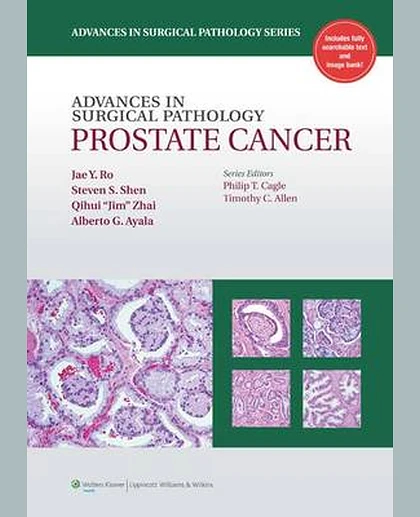 H27Advances in Surgical Pathology: Prostate Cancer