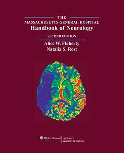 Massachusetts General Hospital Handbook of Neurology