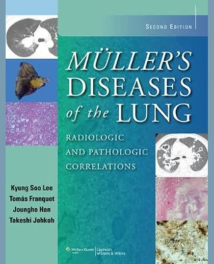 Muller's Diseases of the Lung: Radiologic and Pathologic Correlations