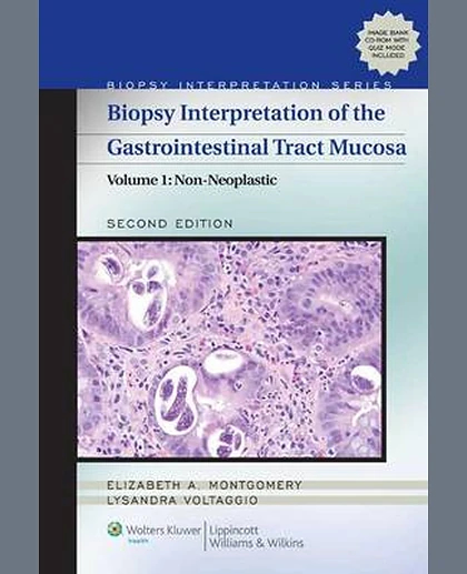 Biopsy Interpretation of the Gastrointestinal Tract Mucosa: Volume 1: Non-Neoplastic