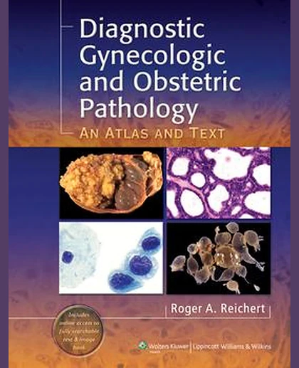 Diagnostic Gynecologic and Obstetric Pathology