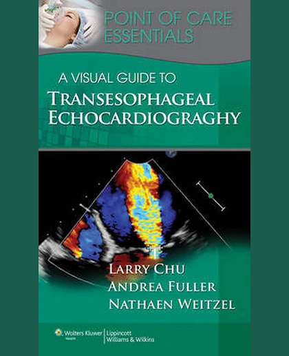 A Visual Guide to Transesophageal Echocardiography
