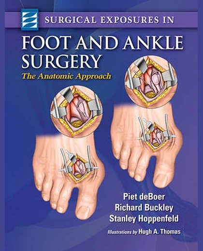 Surgical Exposures in Foot & Ankle Surgery: The Anatomic Approach