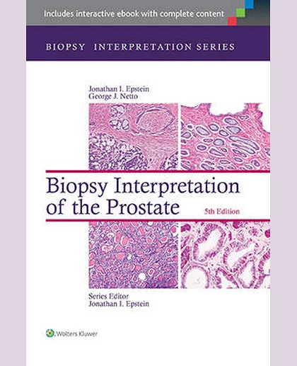 Biopsy Interpretation of the Prostate