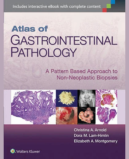 Atlas of Gastrointestinal Pathology: A Pattern Based Approach to Non-Neoplastic Biopsies