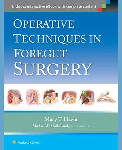 Operative Techniques in Foregut Surgery