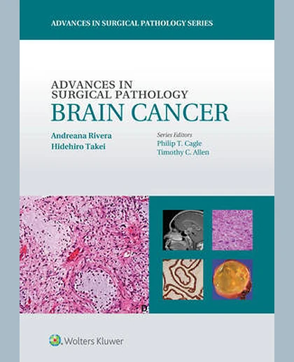 Advances in Surgical Pathology: Brain cancer