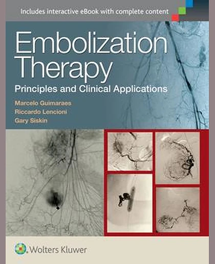 Embolization Therapy: Principles and Clinical Applications