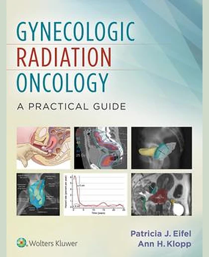 Gynecologic Radiation Oncology: A Practical Guide