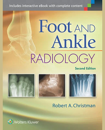 Foot and Ankle Radiology