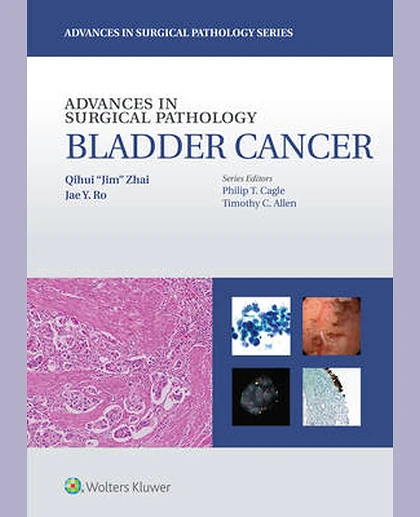 Advances in Surgical Pathology: Bladder cancer