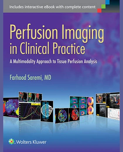 Perfusion Imaging in Clinical Practice: A Multimodality Approach to Tissue Perfusion Analysis