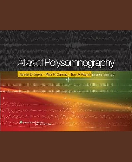Atlas of Polysomnography