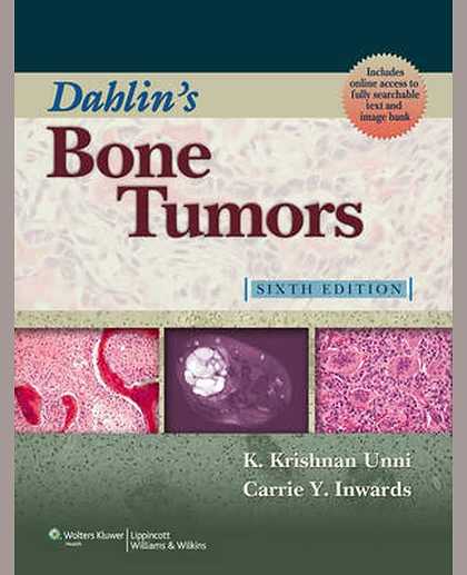 Dahlin's Bone Tumors: General Aspects and Data on 10,165 Cases