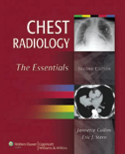Chest Radiology: The Essentials