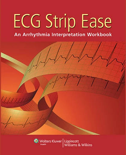 ECG Strip Ease