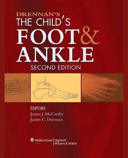 Drennan's the Child's Foot and Ankle