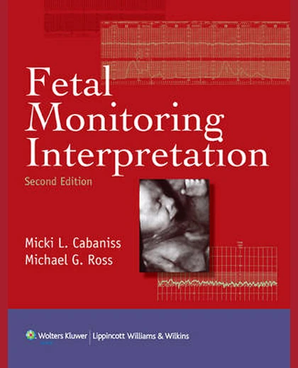 Fetal Monitoring Interpretation