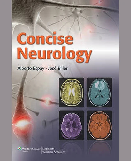 Concise Neurology