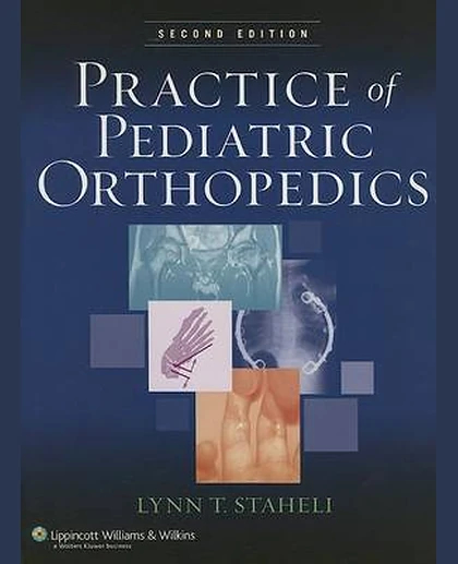 Practice of Pediatric Orthopedics