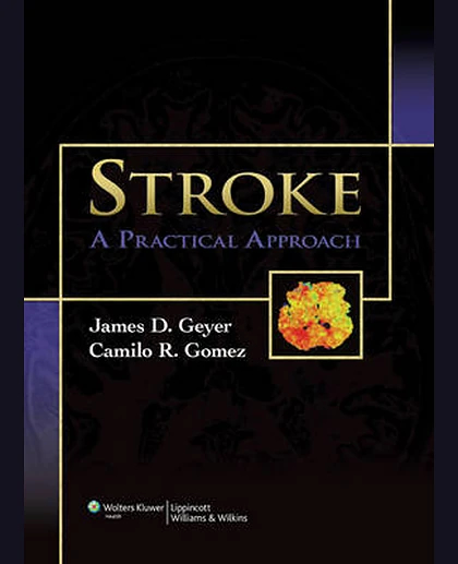 Stroke: A Practical Approach