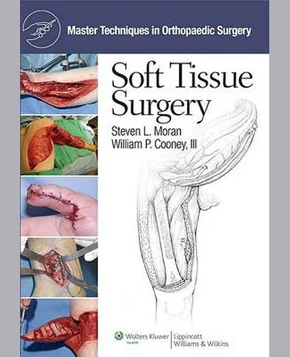 Soft Tissue Surgery
