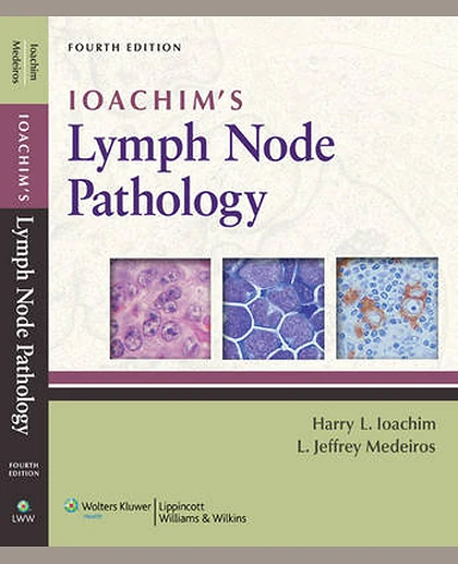Ioachim's Lymph Node Pathology