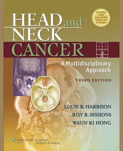 Head and Neck Cancer: A Multidisciplinary Approach