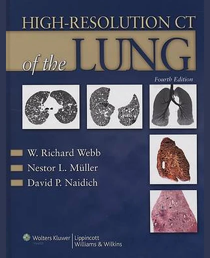 High-resolution CT of the Lung