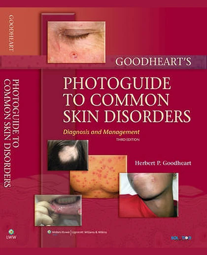 Goodheart's Photoguide to Common Skin Disorders: Diagnosis and Management