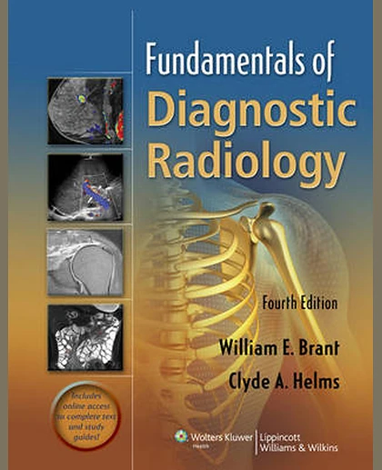 Fundamentals of Diagnostic Radiology