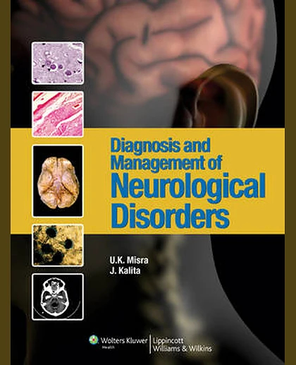 Diagnosis & Management of Neurological Disorders