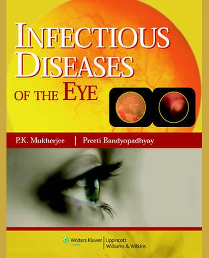 Infectious Diseases of the Eye