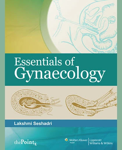 Essentials of Gynaecology
