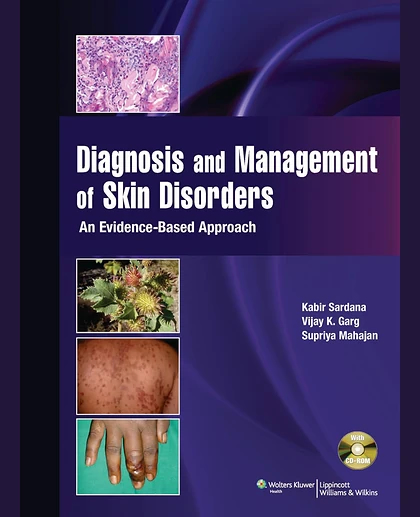 Diagnosis & Management of Skin Disorders