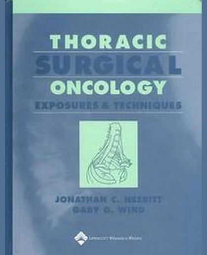 Thoracic Surgical Oncology: Exposures and Techniques