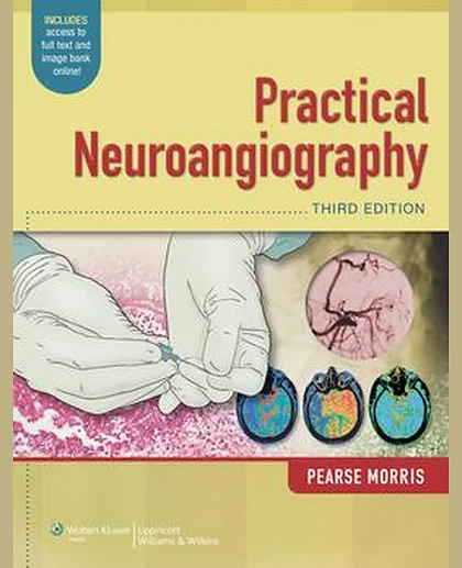Practical Neuroangiography