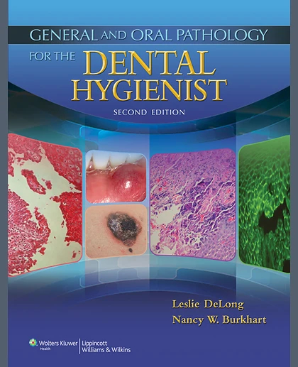 General and Oral Pathology for the Dental Hygienist