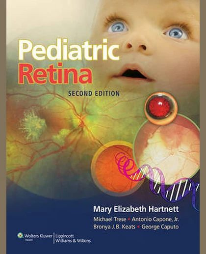 Pediatric Retina