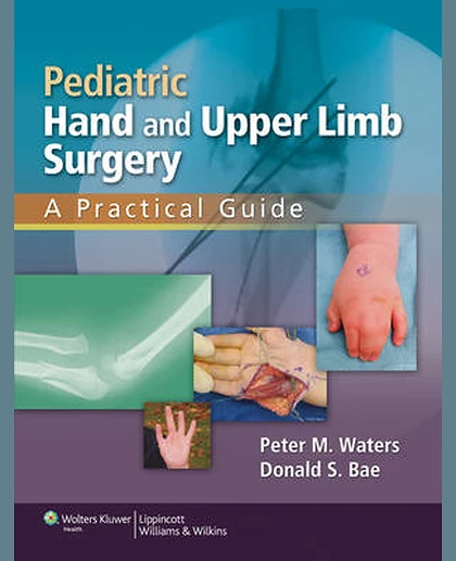 Pediatric Hand and Upper Limb Surgery: A Practical Guide