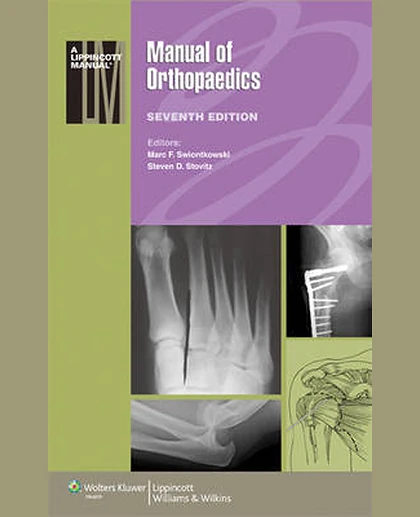 Manual of Orthopaedics