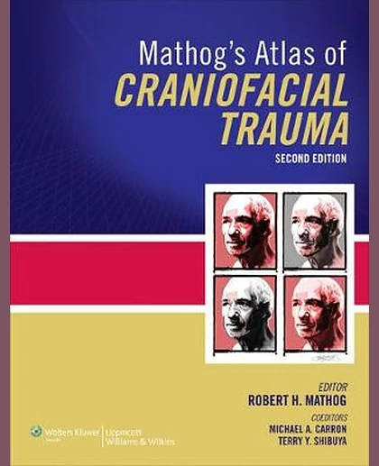 Mathog's Atlas of Craniofacial Trauma