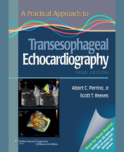 A Practical Approach to Transesophageal Echocardiography