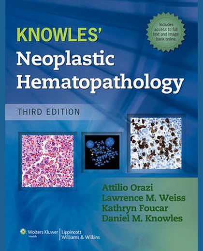 Knowles Neoplastic Hematopathology
