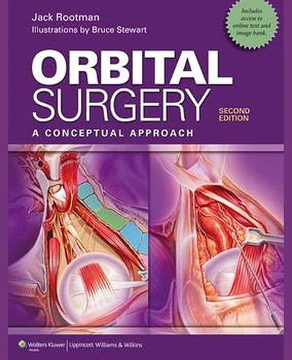 Orbital Surgery