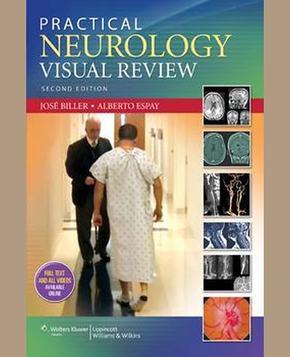 Practical Neurology Visual Review