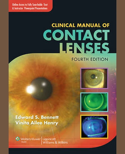 Clinical Manual of Contact Lenses