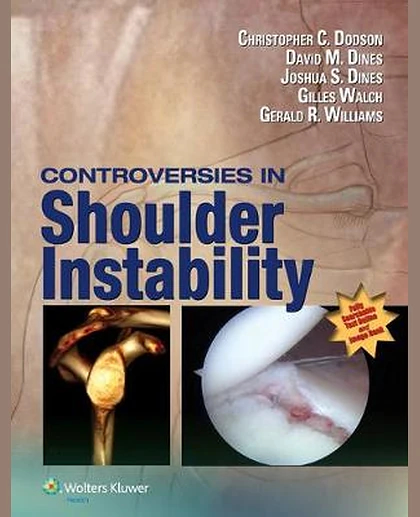 Controversies in Shoulder Instability