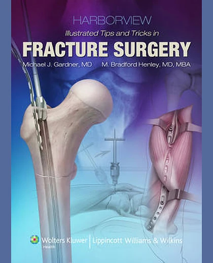 Harborview Illustrated Tips and Tricks in Fracture Surgery, Inkling
