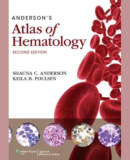 Anderson's Atlas of Hematology: .